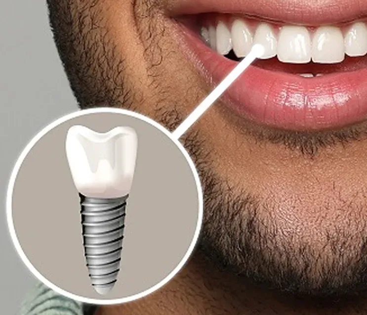 Hero Mobile Background